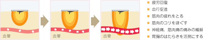 はり治療の効果イメージ